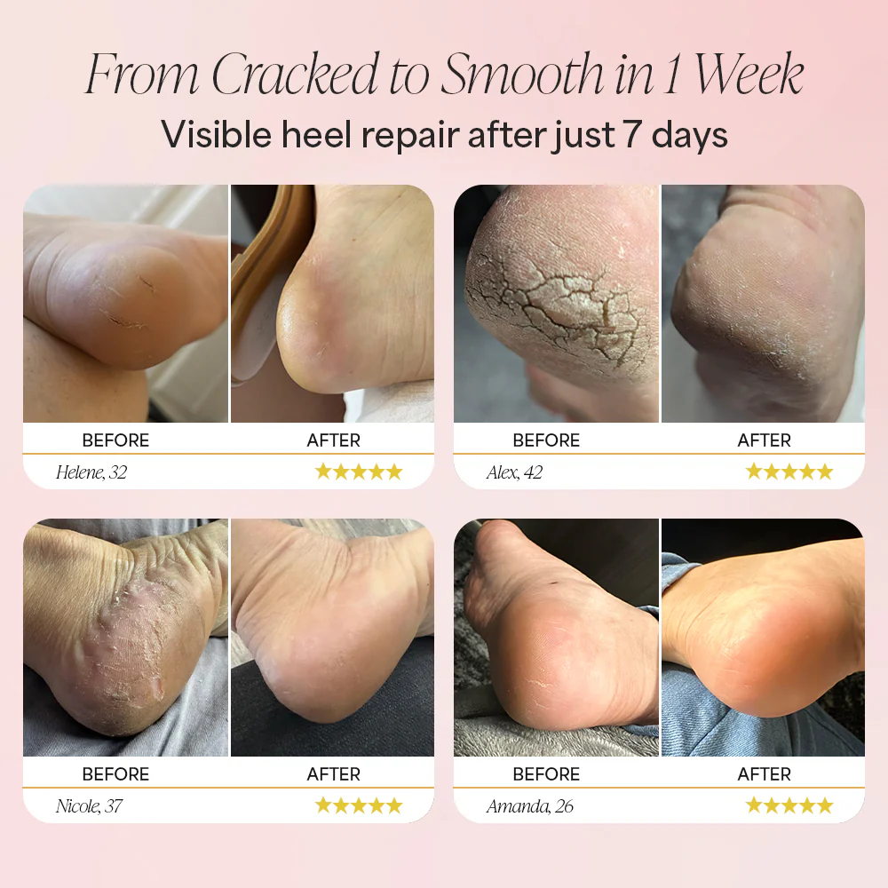 Dermave™ Anti-Crack Foot Cream - Image 4