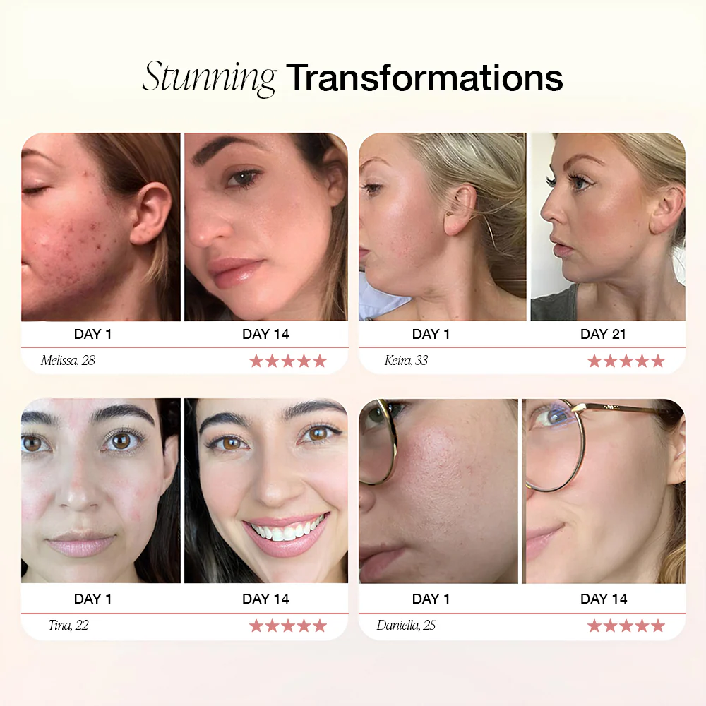 Dermave™ - Image 5