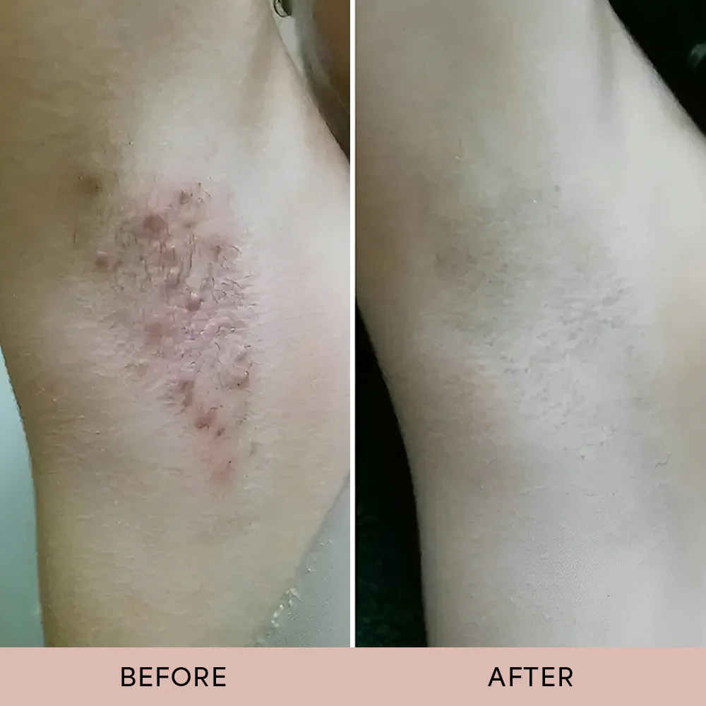 Dermave™ After Trim Oil - Image 2