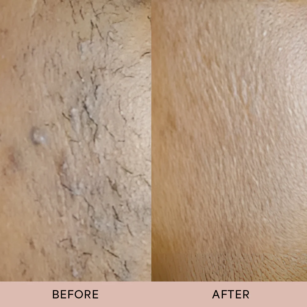 Dermave™ After Trim Oil - Image 4