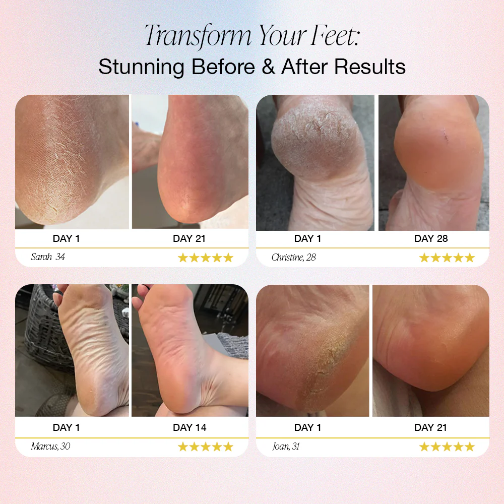Dermave™ Electric Foot Callus Remover - Image 5