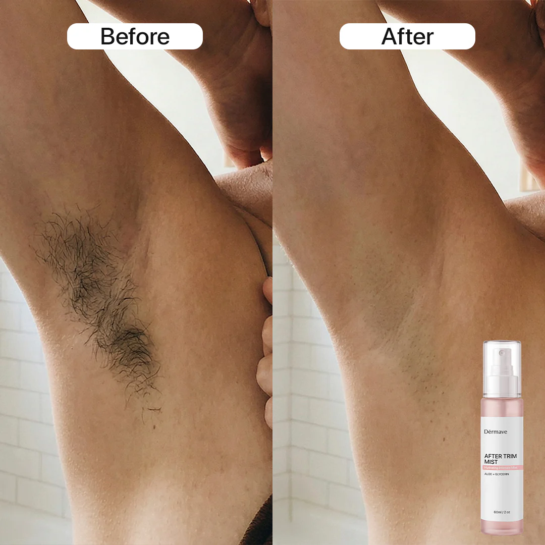 Dermave™ Pre + Post Trim Essentials - Image 2