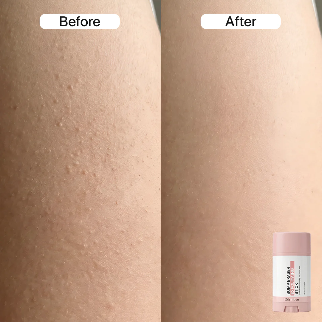 Dermave™ Pre + Post Trim Essentials - Image 3